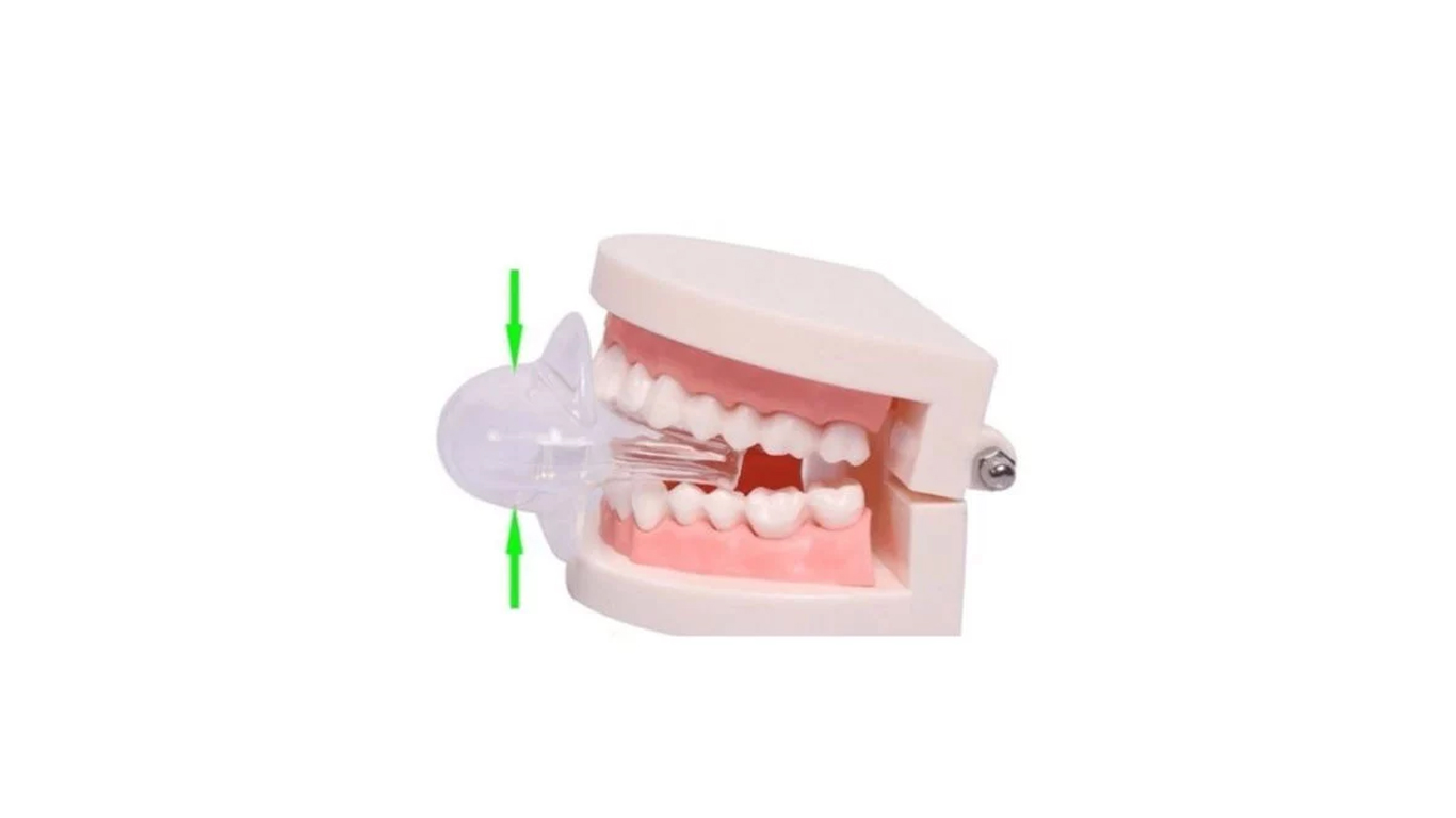 anti-snoring-tongue-device